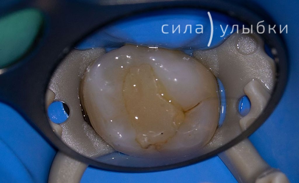 До